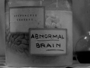 frankenstein-abnormal-brain