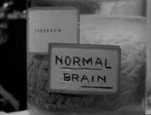 frankenstein-normal-brain